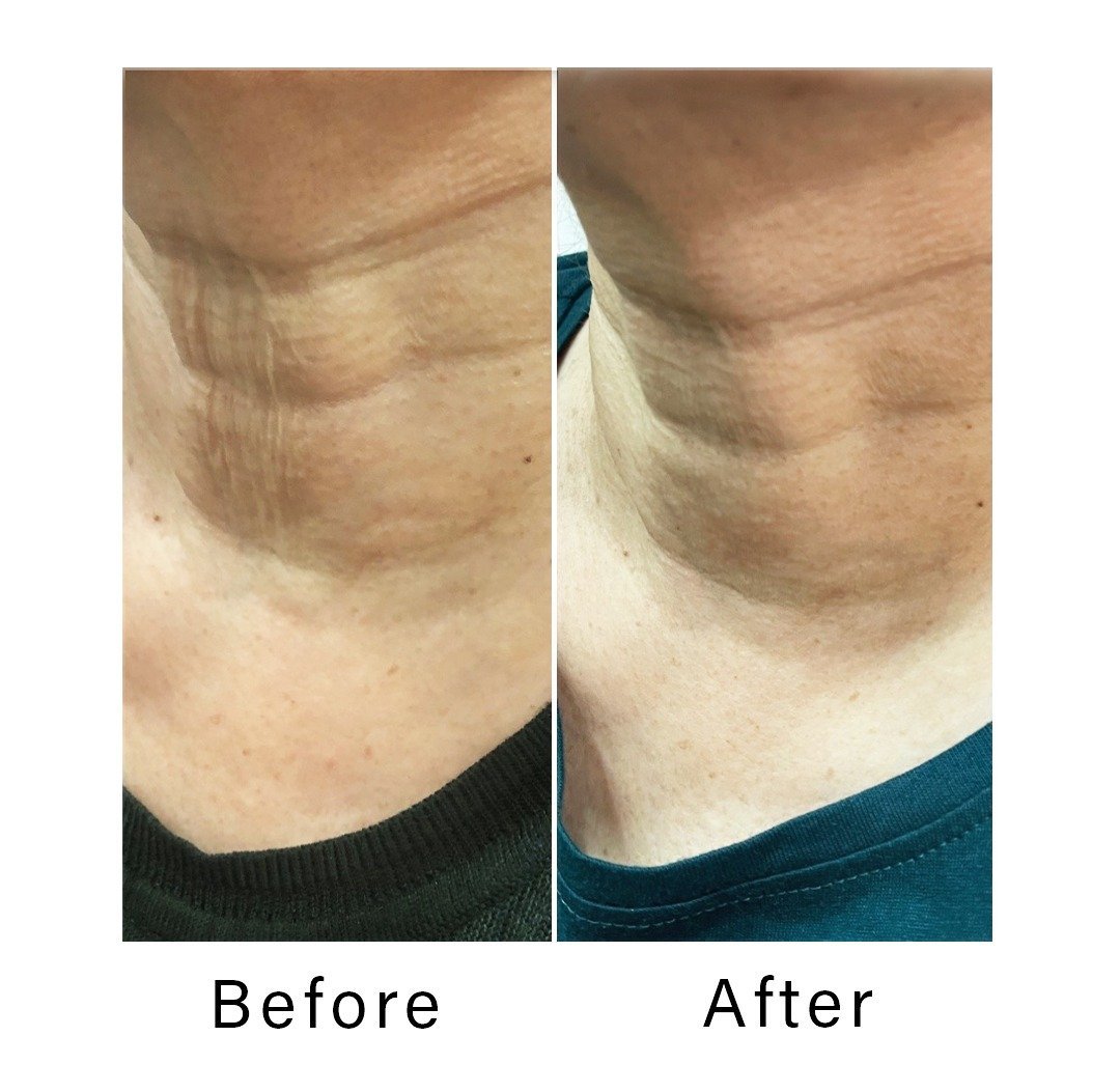 antiageing_best-cosmetologist-in-Andheri.jpeg
